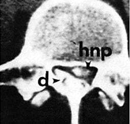 A black and white image of the back end of a head.
