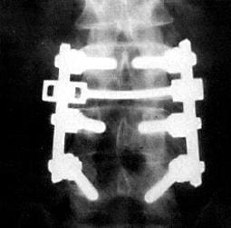 A x-ray of the back end of a motorcycle.